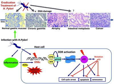 Inflammation, DNA Damage, Helicobacter pylori and Gastric Tumorigenesis